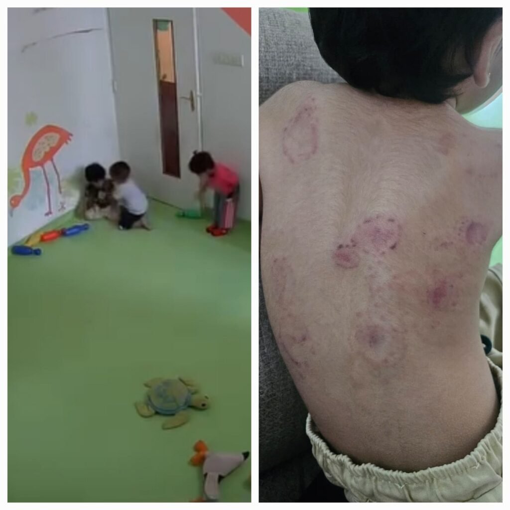 FirstCry Intellitots प्रीस्कूलमधील कथित निष्काळजीपणावर पालकांकडून प्रश्नचिन्ह